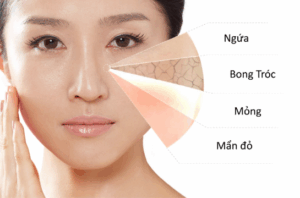 cham-soc-da-nhay-cam-huong-dan-toan-dien
