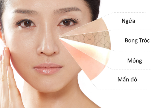 cham-soc-da-nhay-cam-huong-dan-toan-dien