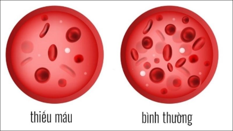 thieu-mau-nguyen-nhan-dau-hieu