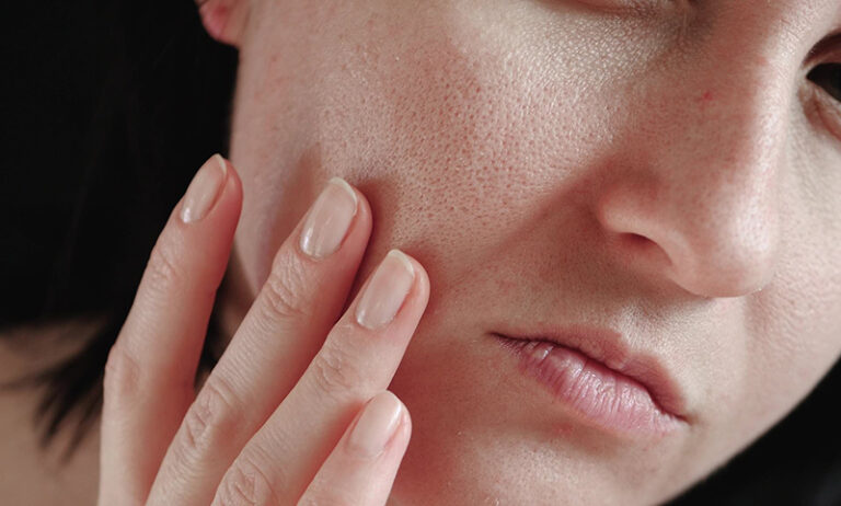 Da Khô Nên Chăm Sóc Thế Nào