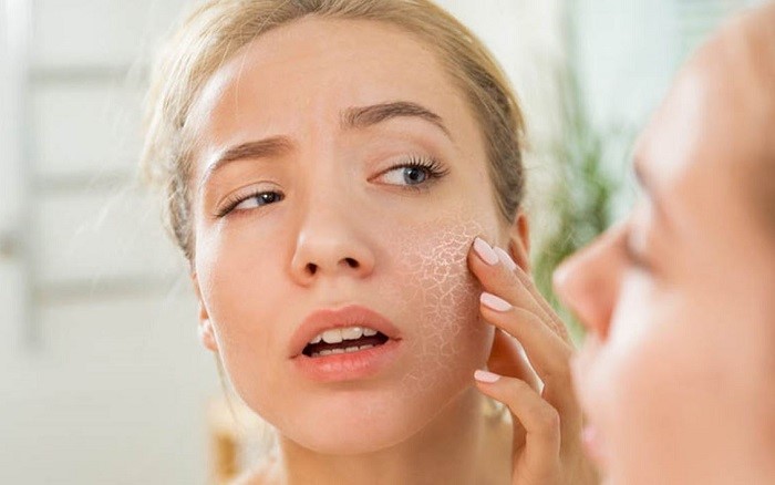 Chăm Sóc Da Khi Thời Tiết Thay Đổimoinhatnhea
